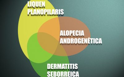 OVERLAP: la superposición de problemas capilares que condicionarán tu tratamiento si no se detecta a tiempo