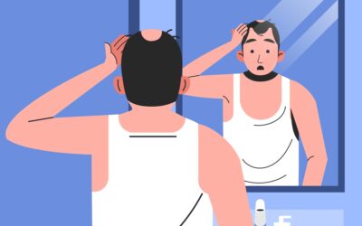 ¿Qué es la alopecia areata?