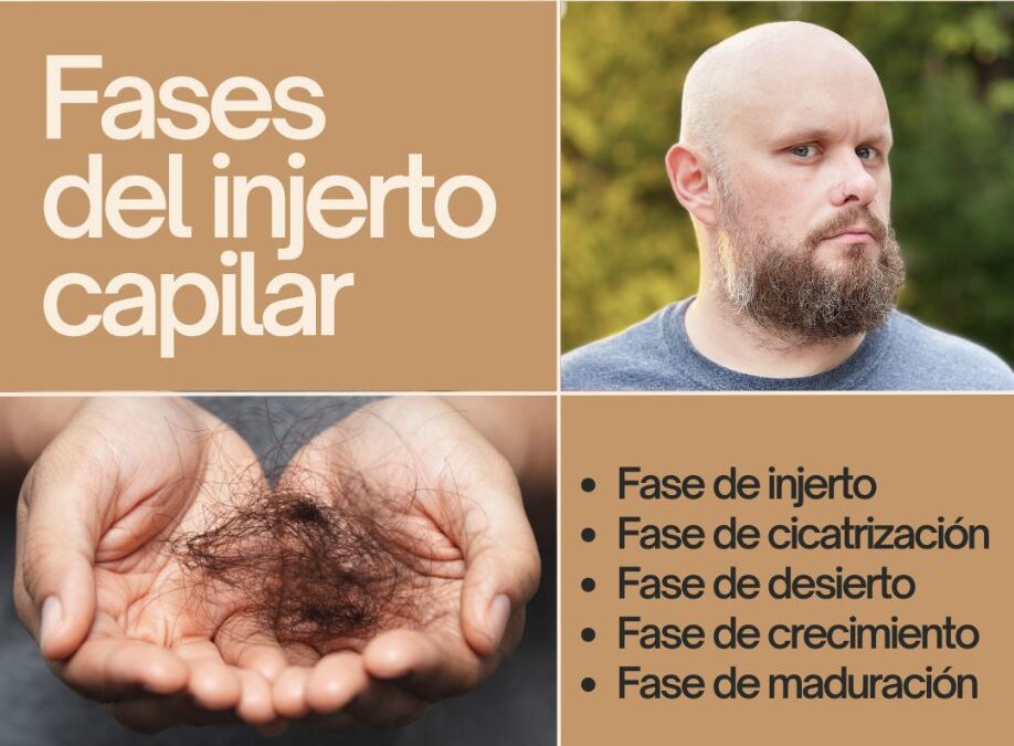 Fases del injerto capilar