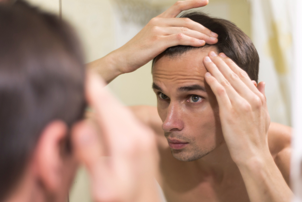 La Escala Hamilton-Norwood para medir la alopecia en hombres