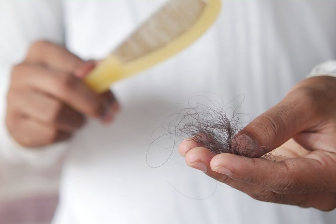 El ciclo de vida del cabello