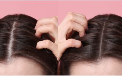 Diferencias entre alopecia femenina y masculina